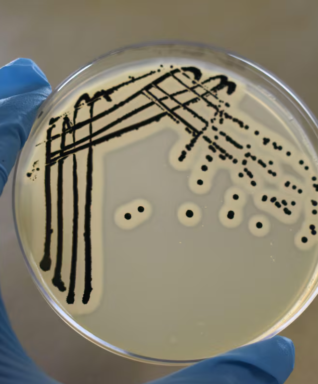  Descubren la doble defensa de una superbacteria para sortear a antibióticos